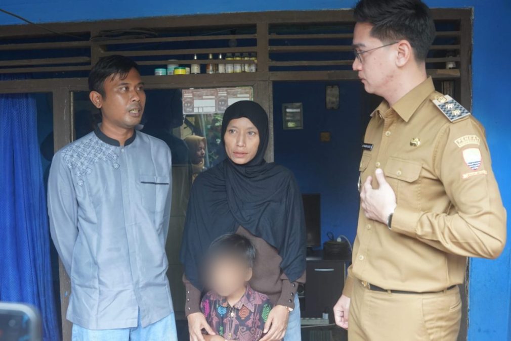 Pemda Sumedang Turun Tangan Bantu Anak Penderita Atresia Ani Segera Jalani Operasi